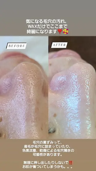 Premier 所属・寺西 さくらのエステ・リラクイメージ