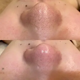 海瀬 浩代のエステ・リラクイメージ