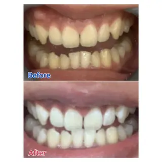 MBEAUTYSALON 千葉店・京成大久保所属・Melty 輝のその他イメージ