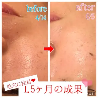 ロング カラー パーマ ヘアアレンジ メンズ キッズ ネイル マツエク・マツパ 四つ星サロン🎖 腸＆ニキビケアに特化のエステ・リラクイメージ