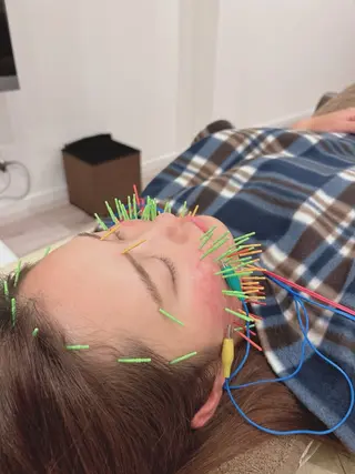 美容鍼灸Solana所属・肌質改善×美容鍼 ゆいのエステ・リラクイメージ