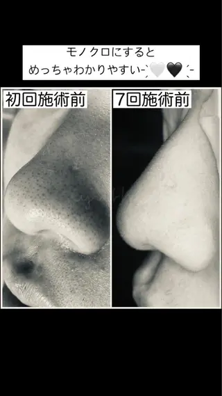 メンズ マツエク・マツパ 毛穴ケア専門店 Cynthiaのエステ・リラクイメージ