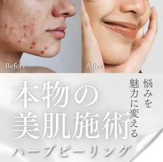 fallon beautyのエステ・リラクイメージ
