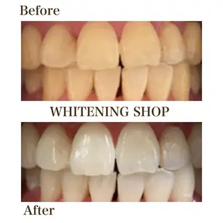 メンズ ホワイトニング ショップ川越店のエステ・リラクイメージ