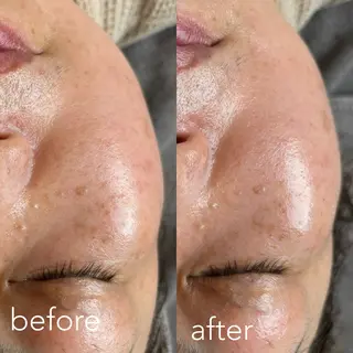 エステティックサロン Liente(リアンテ)所属・Hashimoto .のエステ・リラクイメージ