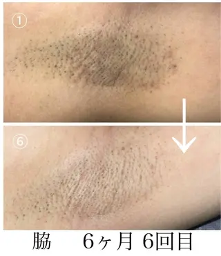 Belle ＋vi（ベル）のその他イメージ