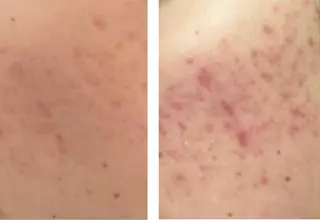 セミロング カラー パーマ ヘアアレンジ メンズ キッズ ネイル マツエク・マツパ アイブロウ ニキビ特化型エステ 🍓最短で肌質改善のエステ・リラクイメージ