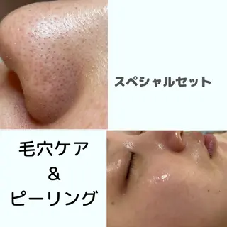 毛穴シミ改善専門 サロンド・ルパークのエステ・リラクイメージ