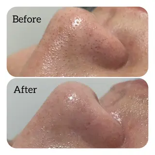 Éclat de Belle🫧白玉肌のエステ・リラクイメージ