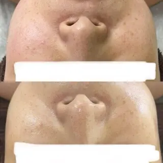 Beauty Salon Ciel　Chiba所属・BeautySalo nCielChibaのエステ・リラクイメージ