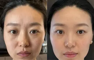 パーマ aliaハイフ&水光ジェットサロン所属・aliaハーブ水光店 エステティシャン募集のエステ・リラクイメージ