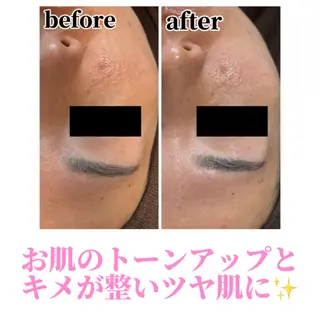 Beauty salonBellのエステ・リラクイメージ