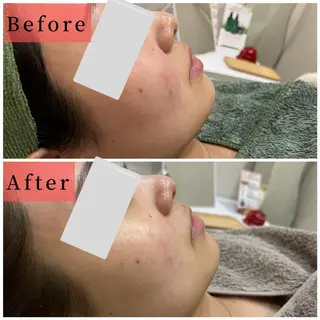 ハーブピーリング専門 muro.のエステ・リラクイメージ