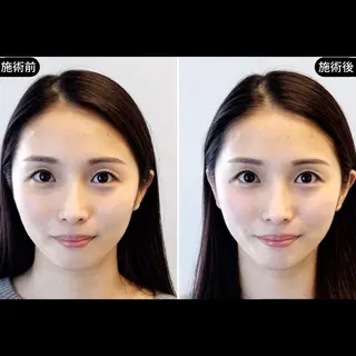 渋谷 小顔美容鍼 専門サロン YZのエステ・リラクイメージ