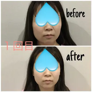 毛穴洗浄・痩身・脱毛 /アルカンジュのエステ・リラクイメージ