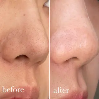 ナリスビューティサロン　デ･アイム長町所属・仙台エステDe'Im 長町🌿湯澤渚のエステ・リラクイメージ