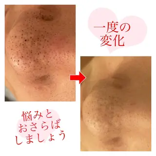 セミロング パーマ ヘアアレンジ メンズ キッズ ネイル マツエク・マツパ 顔タイプ診断 ayakaのエステ・リラクイメージ
