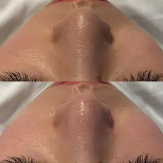 # fu♡のエステ・リラクイメージ