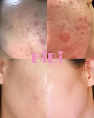 🎀BiBi韓国美容 コスパ強！美活サロンのエステ・リラクイメージ