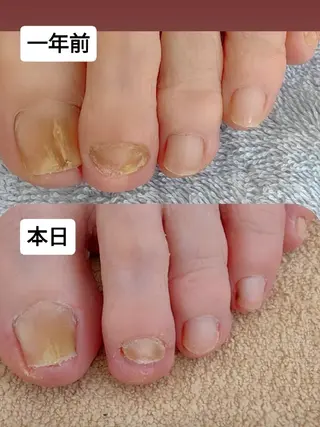 ネイル reve あやののネイルデザイン