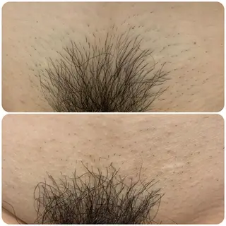 脱毛サロン NR エヌアール所属・NR Nara yukiのエステ・リラクイメージ