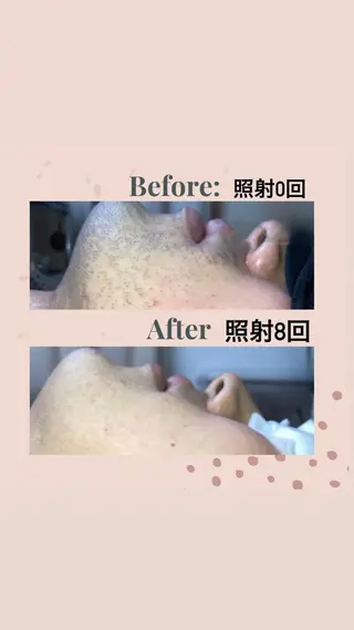 ピーリング＆脱毛 maoのエステ・リラクイメージ