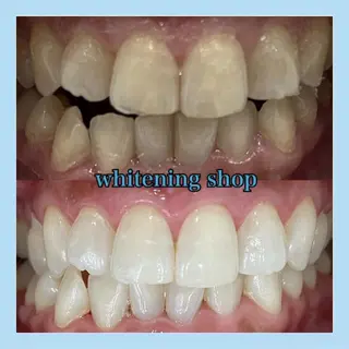 ホワイトニング ショップ千葉店のその他イメージ