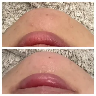 ビューティー ミロワールのエステ・リラクイメージ