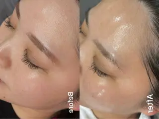 クラスペディア脱毛 ・フェイシャル専門店のエステ・リラクイメージ