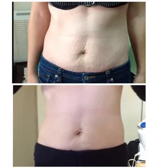 ビューティーホリック 東金店のエステ・リラクイメージ