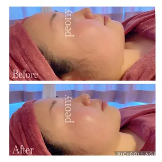 デトックス美容専門サロンｐｅｏｎｙ所属・デトックス美容専門 サロンｐｅｏｎｙのエステ・リラクイメージ