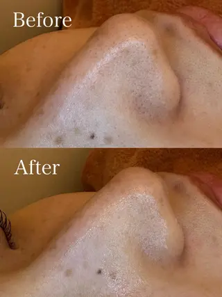 EARTH coiffure beaute 新潟紫竹山店所属・🤍アベシュリ /フェイシャル🤍のエステ・リラクイメージ