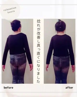 小顔矯正& 慢性肩こり腰痛改善店のエステ・リラクイメージ