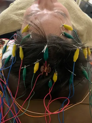 表参道鍼灸院K 美容鍼🔮ララピールのエステ・リラクイメージ