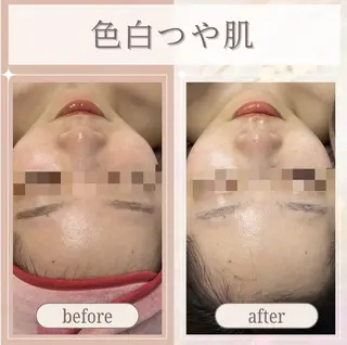 🎀韓国式肌改善🎀 Miku🇰🇷💎のその他イメージ