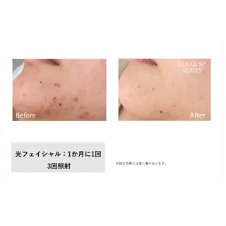 【痩身・脱毛】private salon Eclat所属・伊藤 心のエステ・リラクイメージ