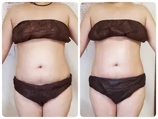 mindplus(マインドプラス)所属・mind plus 【小顔　痩身　脱毛】のエステ・リラクイメージ