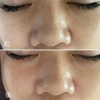 Ring -femのエステ・リラクイメージ