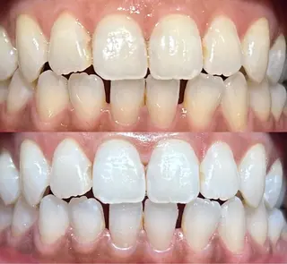 io teeth careのその他イメージ