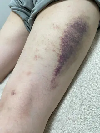 はりすたいる 鍼灸院のエステ・リラクイメージ