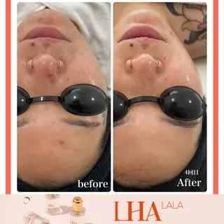 Liam《美肌管理/ 3D小顔/脂肪ケア》のエステ・リラクイメージ