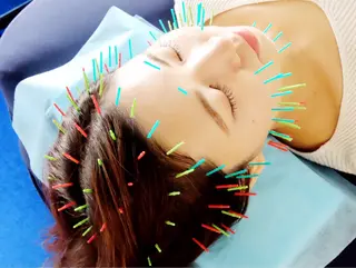 小顔美容鍼専門サロン 渋谷YZのその他イメージ