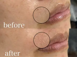 メンズ アイブロウ Three スリーのマツエク・マツパデザイン