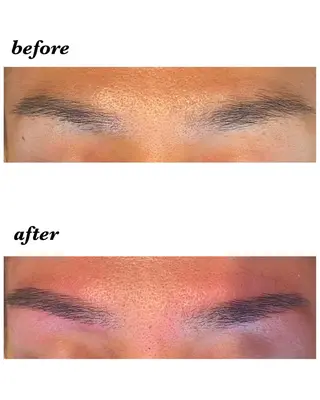 アイブロウ ハーブピーリング/韓国肌管理/フェイシャル/毛穴洗浄/眉毛/顔脱毛【糸脱毛専門】rev所属・ハーブピーリング🌹 毛穴洗浄❤️眉waxのエステ・リラクイメージ