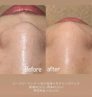 肌質改善サロン🌻 Nico laughのエステ・リラクイメージ