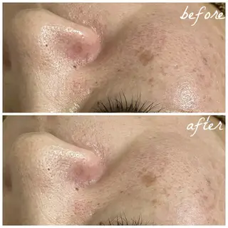 メンズ メナード岐阜茜部 杉浦のエステ・リラクイメージ