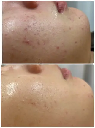 吉祥寺エステサロン Orangeのエステ・リラクイメージ