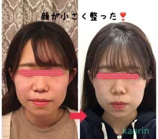 小顔矯正サロン顔凛 KANAのエステ・リラクイメージ