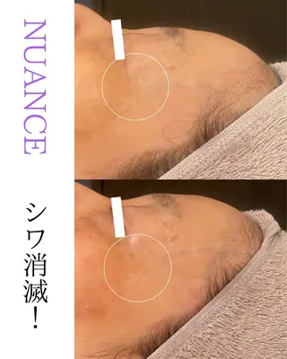 田中For..天王寺 肌質改善/よもぎ蒸しのエステ・リラクイメージ