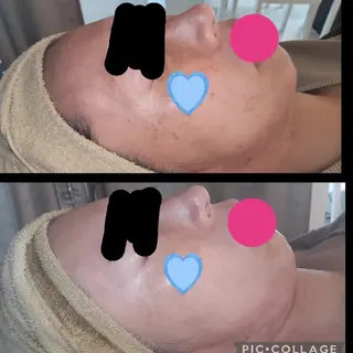 LaCure～ﾗｷｭｱ～所属・岩田 亜季のエステ・リラクイメージ